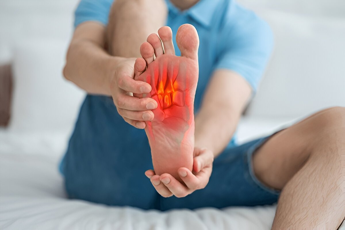 Plantar Fasciitis