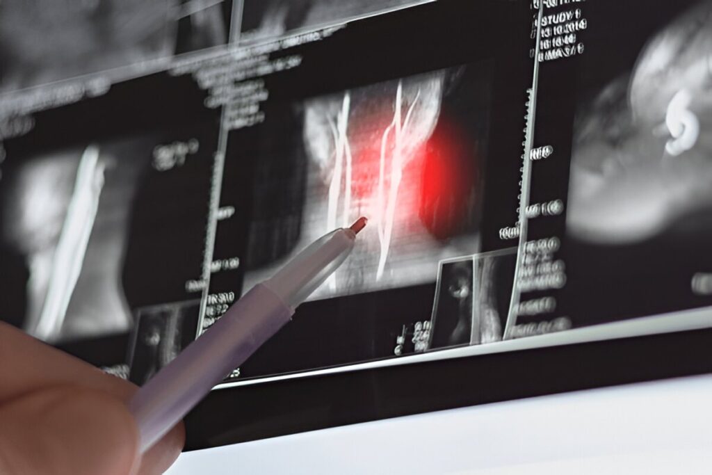 Nerve related neck pain