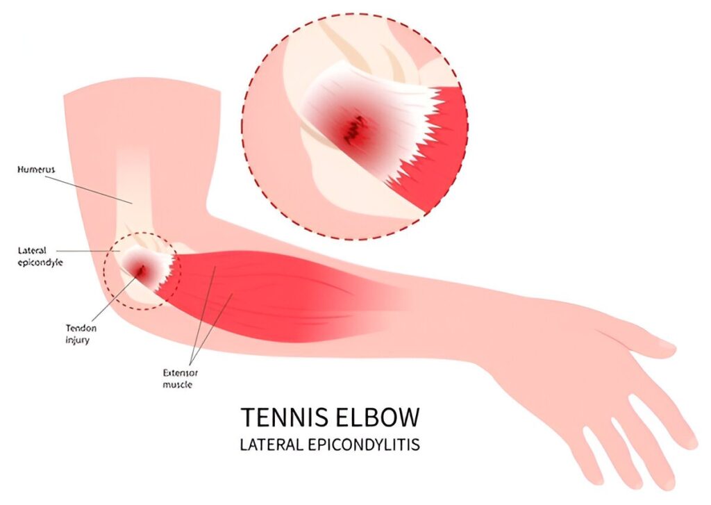 Elbow Enatomy