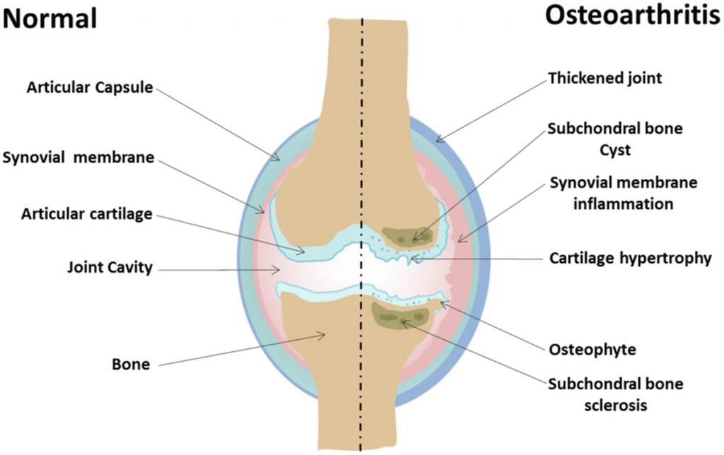 Meniscus Injury - Rapid Physiocare