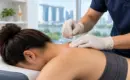 Dry Needling Treatment