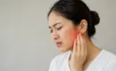 TMJ Physiotherapy