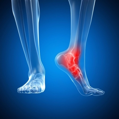 physio foot pain