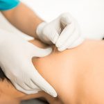 Physiotherapist performing dry needling therapy on patient's shoulder for pain relief