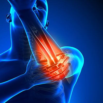 Physiotherapy Treatment for Tennis Elbow