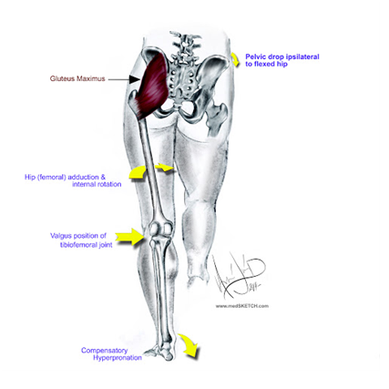 The Secret to “Switching on your Gluteals” - Rapid Physiocare