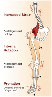 flat feet affect