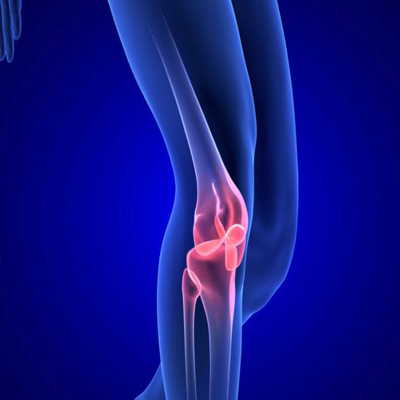 Knee pain Causes, treatments and self-management