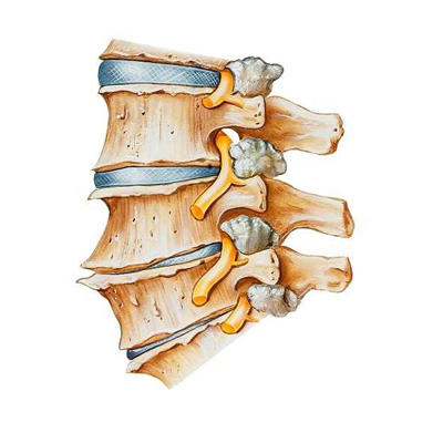 lumbar